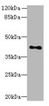 Western blot; All lanes: HTR1E antibody at 3.3µg/ml + Hela whole cell lysate; Secondary; Goat polyclonal to rabbit IgG at 1/10000 dilution; Predicted band size: 42 kDa; Observed band size: 42 kDa