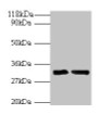 Western blot; All lanes: IL-33 antibody at 2µg/ml; Lane 1: Hela whole cell lysate; Lane 2: Mouse lung tissue; Secondary; Goat polyclonal to rabbit IgG at 1/10000 dilution; Predicted band size: 32 kDa; Observed band size: 32 kDa