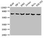 Western Blot; Positive WB detected in: HL60 whole cell lysate, THP-1 whole cell lysate, K562 whole cell lysate, Jurkat whole cell lysate, Hela whole cell lysate, NIH/3T3 whole cell lysate; All lanes: LCP1 antibody at 8µg/ml; Secondary; Goat polyclonal to rabbit IgG at 1/10000 dilution; Predicted band size: 71, 22 kDa; Observed band size: 71 kDa