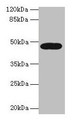 Western blot; All lanes: LIPA antibody at 10µg/ml + A431 whole cell lysate; Secondary; Goat polyclonal to rabbit IgG at 1/10000 dilution; Predicted band size: 46, 40 kDa; Observed band size: 46 kDa