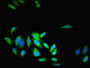 Immunofluorescent analysis of Hela cells using CAC08601 at dilution of 1:100 and Alexa Fluor 488-congugated AffiniPure Goat Anti-Rabbit IgG(H+L)