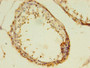 Immunohistochemistry of paraffin-embedded human testis tissue using CAC08615 at dilution of 1:100