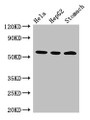 Western Blot; Positive WB detected in: Hela whole cell lysate, HepG2 whole cell lysate, Mouse stomach tissue; All lanes: MDM4 antibody at 3µg/ml; Secondary; Goat polyclonal to rabbit IgG at 1/50000 dilution; Predicted band size: 55, 15, 14, 19, 50 kDa; Observed band size: 55 kDa