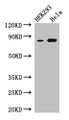 Western Blot; Positive WB detected in: HEK293 whole cell lysate, Hela whole cell lysate; All lanes: MELTF antibody at 3µg/ml; Secondary; Goat polyclonal to rabbit IgG at 1/50000 dilution; Predicted band size: 81, 33 kDa; Observed band size: 81 kDa
