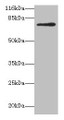 Western blot; All lanes: MTHFR antibody at 2µg/ml + 293T whole cell lysate; Secondary; Goat polyclonal to rabbit IgG at 1/10000 dilution; Predicted band size: 75, 79 kDa; Observed band size: 75 kDa