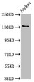 Western Blot; ,Positive WB detected in: Jurkat whole cell lysate; ,All lanes: NPHS1 antibody at 5.6µg/ml; ,Secondary; ,Goat polyclonal to rabbit IgG at 1/50000 dilution; ,Predicted band size: 135, 131 kDa; ,Observed band size: 135 kDa