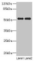 Western blot; All lanes: PAH antibody at 2.5µg/ml; Lane 1: Mouse kidney tissue; Lane 2: Mouse liver tissue; Secondary; Goat polyclonal to rabbit IgG at 1/10000 dilution; Predicted band size: 52 kDa; Observed band size: 52 kDa