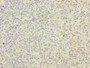 Immunohistochemistry of paraffin-embedded human spleen tissue using CAC08706 at dilution of 1:100