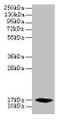 Western blot; All lanes: PFDN2 antibody at 6µg/ml + 293T whole cell lysate; Secondary; Goat polyclonal to rabbit IgG at 1/10000 dilution; Predicted band size: 17 kDa; Observed band size: 17 kDa