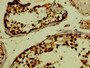 Immunohistochemistry of paraffin-embedded human testis tissue using CAC08722 at dilution of 1:100