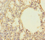 Immunohistochemistry of paraffin-embedded human lung tissue using CAC08756 at dilution of 1:100