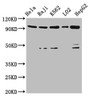 Western Blot; Positive WB detected in: Hela whole cell lysate, Raji whole cell lysate, K562 whole cell lysate, LO2 whole cell lysate, HepG2 whole cell lysate; All lanes: PROM1 antibody at 4.8µg/ml; Secondary; Goat polyclonal to rabbit IgG at 1/50000 dilution; Predicted band size: 98, 97, 94, 93, 95 kDa; Observed band size: 98 kDa;
