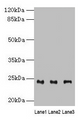 Western blot; All lanes: RAB4B antibody at 4µg/ml; Lane 1: Mouse stomach tissue; Lane 2: Mouse kidney tissue; Lane 3: Mouse gonadal tissue; Secondary; Goat polyclonal to rabbit IgG at 1/10000 dilution; Predicted band size: 24, 28 kDa; Observed band size: 24 kDa