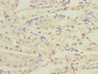 Immunohistochemistry of paraffin-embedded human gastric cancer using CAC08774 at dilution of 1:100