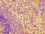 IHC image of CAC08801 diluted at 1:100 and staining in paraffin-embedded human spleen tissue performed on a Leica BondTM system. After dewaxing and hydration, antigen retrieval was mediated by high pressure in a citrate buffer (pH 6.0). Section was blocked with 10% normal goat serum 30min at RT. Then primary antibody (1% BSA) was incubated at 4°C overnight. The primary is detected by a biotinylated secondary antibody and visualized using an HRP conjugated SP system.