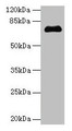 Western blot; All lanes: PMEL antibody at 14µg/ml + Jurkat whole cell lysate; Secondary; Goat polyclonal to rabbit IgG at 1/10000 dilution; Predicted band size: 71, 61, 67 kDa; Observed band size: 71 kDa