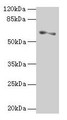 Western blot; All lanes: SLC1A6 antibody at 2µg/ml + A375 whole cell lysate; Secondary; Goat polyclonal to rabbit IgG at 1/10000 dilution; Predicted band size: 62, 35 kDa; Observed band size: 62 kDa