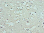 Immunohistochemistry of paraffin-embedded human brain tissue using CAC08848 at dilution of 1:100