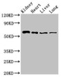 Western Blot; Positive WB detected in: Mouse kidney tissue, Rat heart tissue, Rat liver tissue, Rat lung tissue; All lanes: SLC22A2 antibody at 2.7µg/ml; Secondary; Goat polyclonal to rabbit IgG at 1/50000 dilution; Predicted band size: 63, 55, 27 kDa; Observed band size: 63 kDa;