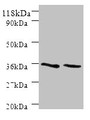 Western blot; All lanes: SNX20 antibody at 2µg/ml; Lane 1: Mouse spleen tissue; Lane 2: Mouse skeletal muscle tissue; Secondary; Goat polyclonal to rabbit IgG at 1/10000 dilution; Predicted band size: 37, 18, 15, 12 kDa; Observed band size: 37 kDa