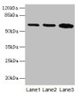 Western blot; All lanes: SPTLC2 antibody at 12µg/ml; Lane 1: HepG2 whole cell lysate; Lane 2: A549 whole cell lysate; Lane 3: HT29 whole cell lysate; Secondary; Goat polyclonal to rabbit IgG at 1/10000 dilution; Predicted band size: 63 kDa; Observed band size: 63 kDa