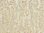Immunohistochemistry of paraffin-embedded human adrenal gland tissue using CAC08868 at dilution of 1:100