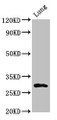 Western Blot; ,Positive WB detected in: Rat lung tissue; ,All lanes: SYNPR antibody at 3µg/ml; ,Secondary; ,Goat polyclonal to rabbit IgG at 1/50000 dilution; ,Predicted band size: 30, 32 kDa; ,Observed band size: 30 kDa