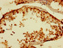 Immunohistochemistry of paraffin-embedded human testis tissue using CAC08942 at dilution of 1:100