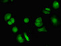 Immunofluorescent analysis of MCF-7 cells using CAC08972 at dilution of 1:100 and Alexa Fluor 488-congugated AffiniPure Goat Anti-Rabbit IgG(H+L)