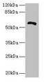 Western blot; All lanes: ZBTB18 antibody at 14µg/ml + Hela whole cell lysate; Secondary; Goat polyclonal to rabbit IgG at 1/10000 dilution; Predicted band size: 59, 60 kDa; Observed band size: 59 kDa