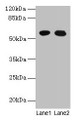 Western blot; All lanes: GTPBP6 antibody at 6µg/ml; Lane 1: A549 whole cell lysate; Lane 2: Hela whole cell lysate; Secondary; Goat polyclonal to rabbit IgG at 1/10000 dilution; Predicted band size: 57 kDa; Observed band size: 57 kDa