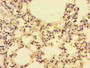 Immunohistochemistry of paraffin-embedded human lung tissue using CAC09072 at dilution of 1:100