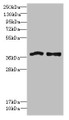 Western blot; All lanes: FPR1 antibody at 6µg/ml; Lane 1: Colo320 whole cell lysate; Lane 2: HT29 whole cell lysate; Secondary; Goat polyclonal to rabbit IgG at 1/10000 dilution; Predicted band size: 39 kDa; Observed band size: 39 kDa