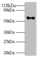 Western blot; All lanes: Major capsid protein L1 antibody at 2µg/ml + 293T whole cell lysate; Secondary; Goat polyclonal to rabbit IgG at 1/10000 dilution; Predicted band size: 62 kDa; Observed band size: 62 kDa;