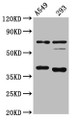 Western Blot; Positive WB detected in: A549 whole cell lysate, 293 whole cell lysate; All lanes: CTSS antibody at 1:4000; Secondary; Goat polyclonal to rabbit IgG at 1/50000 dilution; Predicted band size: 38, 32 kDa; Observed band size: 38 kDa