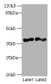 Western blot; All lanes: DNAJB4 antibody at 2µg/ml; Lane 1: Hela whole cell lysate; Lane 2: Mouse heart tissue; Secondary; Goat polyclonal to rabbit IgG at 1/10000 dilution; Predicted band size: 38 kDa; Observed band size: 38 kDa