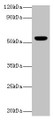 Western blot; All lanes: CHRNA1 antibody at 2µg/ml + Rat skeletal muscle tissue; Secondary; Goat polyclonal to rabbit IgG at 1/10000 dilution; Predicted band size: 55, 52 kDa; Observed band size: 55 kDa