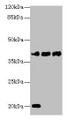 Western blot; ,All lanes: STEAP1 antibody at 1µg/ml; ,Lane 1: U87 whole cell lysate; ,Lane 2: A431 whole cell lysate; ,Lane 3: A549 whole cell lysate; ,Secondary; ,Goat polyclonal to rabbit IgG at 1/10000 dilution; ,Predicted band size: 40 kDa; ,Observed band size: 40 kDa