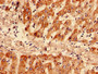 Immunohistochemistry analysis of human liver tissue using CAC09172 at dilution of 1:100