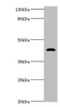 Western blot; All lanes: HP antibody at 2µg/ml + Mouse stomach tissue; Secondary; Goat polyclonal to rabbit IgG at 1/10000 dilution; Predicted band size: 46, 39 kDa; Observed band size: 46 kDa