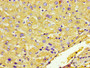 IHC image diluted at 1:600 and staining in paraffin-embedded human liver tissue performed on a Leica BondTM system. After dewaxing and hydration, antigen retrieval was mediated by high pressure in a citrate buffer (pH 6.0). Section was blocked with 10% normal goat serum 30min at RT. Then primary antibody (1% BSA) was incubated at 4°C overnight. The primary is detected by a biotinylated secondary antibody and visualized using an HRP conjugated ABC system.