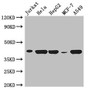 Western Blot; Positive WB detected in: Jurkat whole cell lysate, Hela whole cell lysate, HepG2 whole cell lysate, MCF-7 whole cell lysate, A549 whole cell lysate; All lanes: HLA-B antibody at 3µg/ml; Secondary; Goat polyclonal to rabbit IgG at 1/50000 dilution; Predicted band size: 41 kDa; Observed band size: 41 kDa