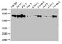 Western Blot; Positive WB detected in: HEK293 whole cell lysate, Jurkat whole cell lysate, MCF-7 whole cell lysate, Rat heart tissue, Rat kideny tissue, Rat stomach tissue, Mouse heart tissue, Mouse kidney tissue, Mouse stomach tissue; All lanes: PRKCH antibody at 3.5µg/ml; Secondary; Goat polyclonal to rabbit IgG at 1/50000 dilution; Predicted band size: 78, 60 kDa; Observed band size: 78 kDa