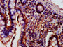 IHC image diluted at 1:700 and staining in paraffin-embedded human small intestine tissue performed on a Leica BondTM system. After dewaxing and hydration, antigen retrieval was mediated by high pressure in a citrate buffer (pH 6.0). Section was blocked with 10% normal goat serum 30min at RT. Then primary antibody (1% BSA) was incubated at 4°C overnight. The primary is detected by a biotinylated secondary antibody and visualized using an HRP conjugated SP system.