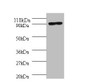 Western blot; All lanes: Aquaticus DNA polymerase I, thermostable antibody at 2µg/ml + 293T whole cell lysate; Secondary; Goat polyclonal to rabbit IgG at 1/10000 dilution; Predicted band size: 94 kDa; Observed band size: 94 kDa;