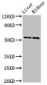 Western Blot; ,Positive WB detected in: Mouse liver tissue, Mouse kidney tissue; ,All lanes: Mmp3 antibody at 2.8µg/ml; ,Secondary; ,Goat polyclonal to rabbit IgG at 1/50000 dilution; ,Predicted band size: 54 kDa; ,Observed band size: 54 kDa