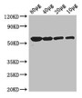 Western Blot; Positive WB detected in: Rosseta bacteria lysate at 80µg, 40µg, 20µg, 10µg; All lanes: glpK antibody at 3µg/ml; Secondary; Goat polyclonal to rabbit IgG at 1/50000 dilution; Predicted band size: 57 kDa; Observed band size: 57 kDa