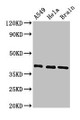 Western Blot; Positive WB detected in: A549 whole cell lysate, Hela whole cell lysate, Mouse brain tissue; All lanes: HLA-C antibody at 3.4µg/ml; Secondary; Goat polyclonal to rabbit IgG at 1/50000 dilution; Predicted band size: 41 kDa; Observed band size: 41 kDa