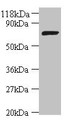 Western blot; All lanes: DNA ligase antibody at 2µg/ml + DH5a whole cell lysate; Secondary; Goat polyclonal to rabbit IgG at 1/10000 dilution; Predicted band size: 74 kDa; Observed band size: 74 kDa;