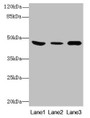 Western Blot; All lanes: B4GALT5 antibody at 8µg/ml; Lane 1: Mouse heart tissue; Lane 2: Mouse liver tissue; Lane 3: Mouse brain tissue; Secondary; Goat polyclonal to rabbit IgG at 1/10000 dilution; Predicted band size: 46 kDa; Observed band size: 46 kDa